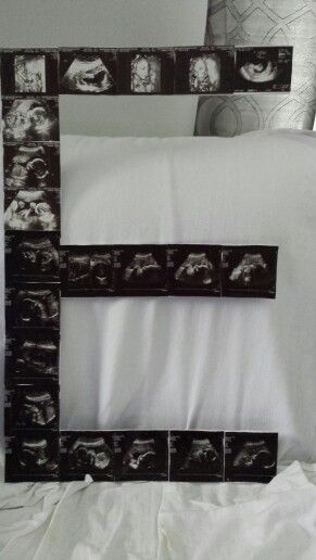 My ultrasounds pictures for my daughter's first initial. Perfect for nursery decor. Baby Ultrasound Pictures, Pictures Collage, Sublimacion Ideas, Baby Ultrasound, Ultrasound Pictures, Nursery Room Boy, Baby Memories, Reveal Ideas, Expecting Baby