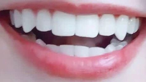 Fang Teeth Natural Aesthetic, Fang Teeth Aesthetic, Perfect Teeth Aesthetic Vampire, Teeth With Natural Fangs, Lips Claims For Dr, Eyelash Claims For Dr, Lip Claims For Dr, Natural Vampire Teeth, Natural Fangs Teeth