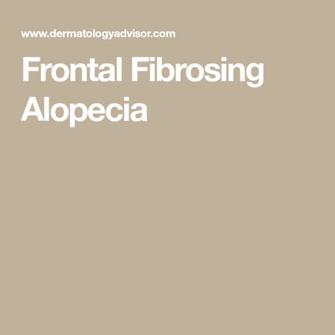 Frontal Fibrosing Alopecia Lichen Planopilaris, Frontal Fibrosing Alopecia, Alopecia Awareness, History Women, Ffa, Farmhouse Style Decorating, Dermatology, Side Effects, The History