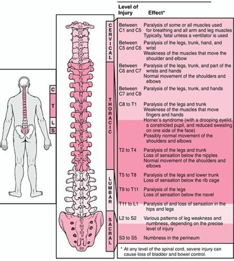 Effects of Spinal Injury Geriatric Occupational Therapy, Cauda Equina, Nerve Disorders, Spinal Nerve, Spinal Injury, Spine Health, Nursing Notes, Spinal Cord, Neurology