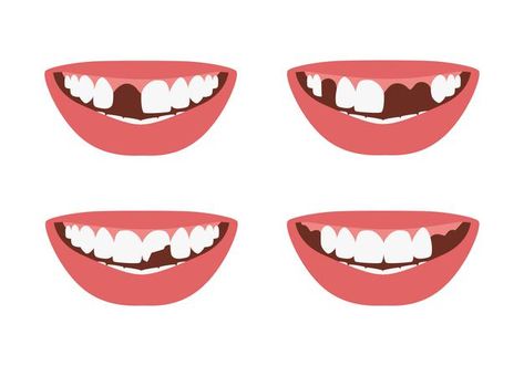 Smile Tips, Molar Tooth, Missing Teeth, Smile Teeth, Fashion Graphic Design, Bright Smile, First Tooth, Fashion Graphic, Tooth Decay