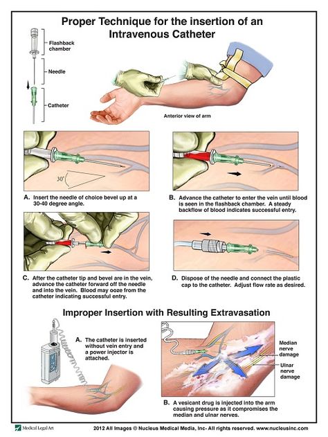 50 Intravenous Therapy (IV) Tips and Tricks For Nurses Nursing Iv, Nursing Information, Intravenous Therapy, Nursing Schools, Nursing School Survival, Nursing School Studying, Nursing School Tips, Nursing School Notes, Iv Therapy