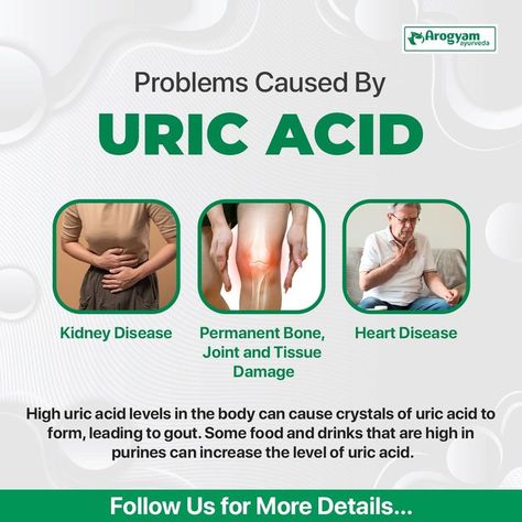 #cause #high #uricacid #level #waste #product #found #blood #bone #tissue #damage #food #drinks #highpurines #problems #ayurveda #natural #treatment #Arogyamjalandhar
#arogyamclinic #foryou #viral #trending #pinterest #explore Uric Acid Levels, Healthy Advice, Uric Acid, Kidney Health, How To Do Yoga, Ayurveda, Natural Health, Natural Skin Care, Chemicals