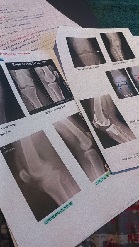 Radiologic Technologist Aesthetic, Radiographer Aesthetic, X-ray Tech, X Ray Technician Aesthetic, Radiography Student Aesthetic, Xray Tech Aesthetic, X Ray Tech Student, Radiology Student Study, Rad Tech Aesthetic