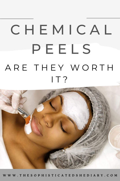 Unlocking the Secrets of Chemical Peels—Are Chemical Peels the Key to Your Ultimate Glow? Let's find out #Skincaretruths #Skincaresecrets Chemical Peels, Facial Peel, Glamorous Makeup, Peeling Skin, Chemical Peel, Diy Beauty Hacks, Radiant Skin, Diy Beauty, Worth It