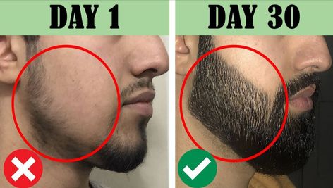 If you want beautiful beard this video is for you. Watch this video fully. Beard Growth Tips How To Grow, Beard Growth Tips, Natural Beard Growth, Growing Facial Hair, Beard Growth, Grow Beard, Beard Oil, Grow Out, Facial Hair