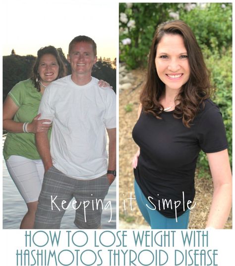 How to Lose Weight with Hashimotos Thyroid Disease- My Journey to a Healthy Lifestyle • Keeping it Simple Hashimotos Disease Diet, Hashimotos Disease, L Tyrosine, Keeping It Simple, Thyroid Health, A Healthy Lifestyle, Weight Watchers, Blue And Green, Disease