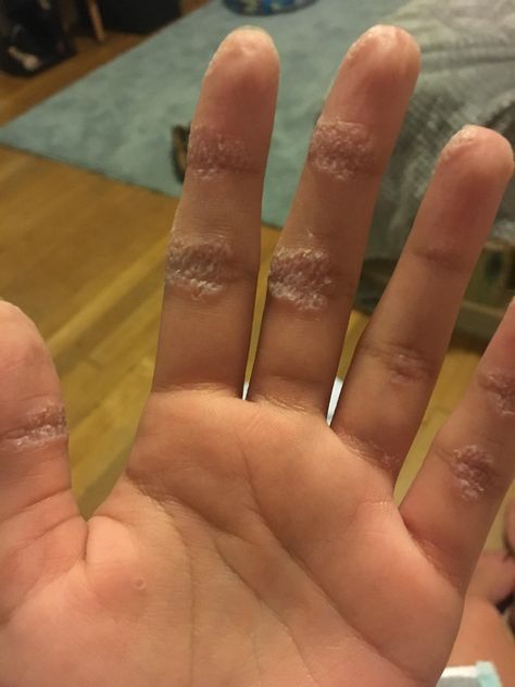 my hands get really wrinkly after showers Cool Instagram Pictures, Cute Eyes, Guilty Pleasures, Instagram Pictures