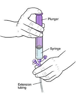 Your Child's Nasogastric Tube: Flushing the Tube | Saint Luke's Health System Nasogastric Tube Nursing, Nasogastric Tube, Home Health Nurse, Numbers To Call, Hospital Staff, Feeding Tube, Health System, Going Home, Home Health