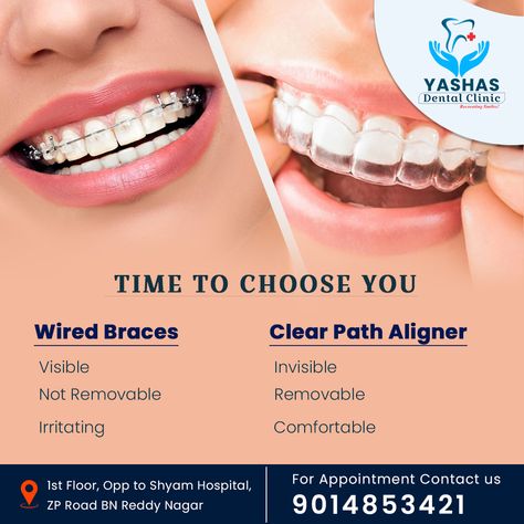 Time to choose you | Wired Braces | Clear Path Aligner | #wiredbraces #clearpathaligners #aligners #wiredbraces #braces #invisible #invisalign #removable Braces Clear, Clear Braces, Dental Clinic, Graphic Designs, Braces