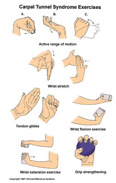 Carpal Tunnel Relief Exercises, Carpal Tunnel Remedies, Hand Therapy Exercises, Carpal Tunnel Exercises, Carpal Tunnel Surgery, Carpal Tunnel Relief, Wrist Exercises, Physical Therapy Exercises, Hand Exercises