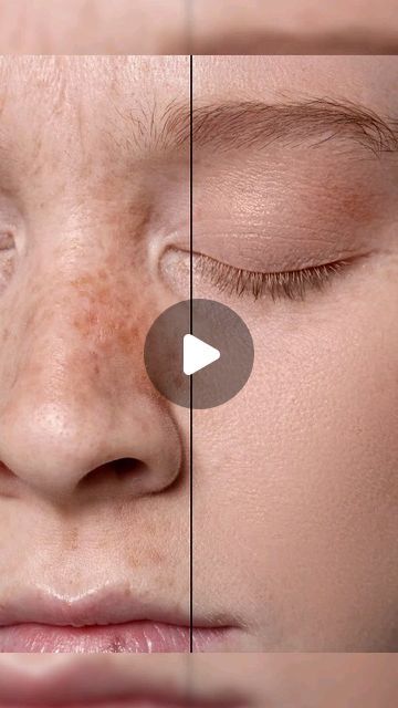 Skin Retouching, Skin Blemishes, February 19, Photoshop Tutorial, Photoshop, Skin, On Instagram, Instagram, Art