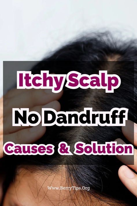 Suffering from an itchy scalp with no sign of dandruff or lice can be a frustrating experience. By identifying potential causes, relief can be found. #DryItchyScalp #ItchyScalp #ItchyScalpRemedy #ItchyScalpNoDandruff Itchy Scalp Causes, Itchy Scalp Remedy, Dry Scalp Remedy, Shampoo For Itchy Scalp, Dandruff Causes, Spotless Skin, Dandruff Remedy, Getting Rid Of Dandruff, Dry Itchy Scalp