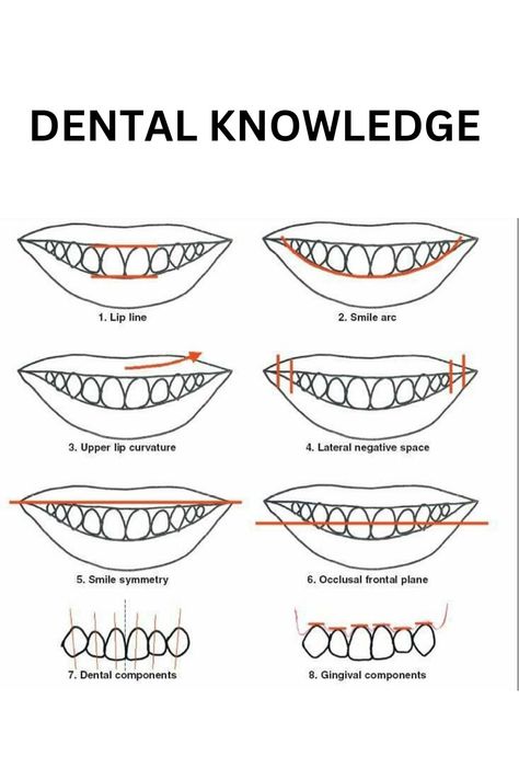 Did you know facts #oralcare #healthyteeth #whitesmile #teethwhitening Cosmetic Dentistry Procedures, Dental Videos, Cleaning Diy, Teeth Health, White Smile, Did You Know Facts, Smile Design, Upper Lip, How To Line Lips