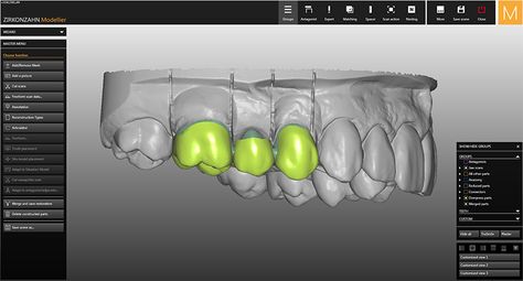 Exocad Dental Design, Dental Implant Poster, Digital Smile Design Dental, Rubber Dam Dental, Dental Technology Logo, Cad Cam, Software