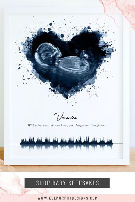 Preserve this precious moment with a watercolor ultrasound or embryo design. This piece can be personalized with your custom wording such as baby's name, birth stats and/or special quote. This is a wonderful gift idea for new parents, a couple who has experienced fertility issues, to memorialize an angel baby, a surrogate present, or for your pregnancy announcement. #ultrasoundart #embryoart #babykeepsake #babyshowergift #newmomgift Birth Memory Ideas, Sonogram Keepsake Ideas, Hand Casting Ideas Family Of 3, Ultrasound Keepsake Ideas, Ultra Sound Picture Ideas, Custom Gift Ideas For Him, Baby Memories Ideas, Pregnancy Keepsake Ideas, Ultrasound Pictures Display