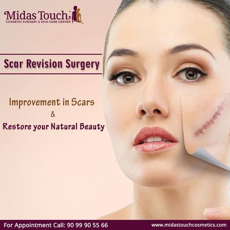 Scar Revision Surgery Improvement in scars & restore your natural beauty at Midas Touch Cosmetic  Book Appointment: Call: 9099905566 Visit: www.midastouchcosmetic.com  #ScarRevision #ScarSurgery #SkinCare #MidasTouchCosmetic Scar Revision, Laser Skin Tightening, Skin Care Center, Midas Touch, Dental Cosmetics, Book Appointment, Scar Removal, Medical Spa, Skin Care Treatments