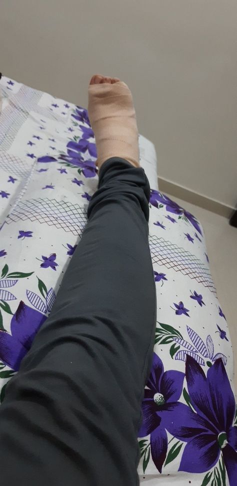 Leg Injury Insta Story, Back Injury Snapchat, Football Injury Snapchat, Hospital Leg Injury, Fractured Leg Snap, Leg Photo Snapchat, Leg Accident Real Pic In Hospital, Hand Plaster Fracture Snap, Hand Fracture Fake Story