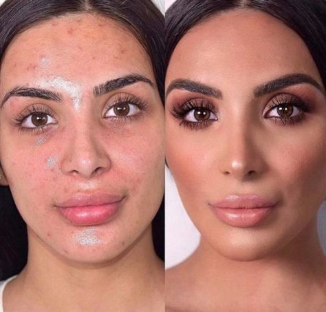 Acne Coverage, Painted Masks, Acne Beauty, Statement Makeup, Full Coverage Makeup, Theatre Makeup, Makeup Before And After, High Fashion Makeup, Power Of Makeup