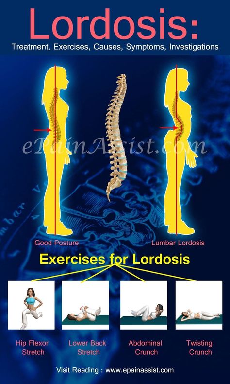 Lordosis Exercises, Lumbar Exercises, Yoga And Stretching, Lumbar Lordosis, Nervus Vagus, Posture Exercises, Spine Health, Back Pain Exercises, Sports Injury