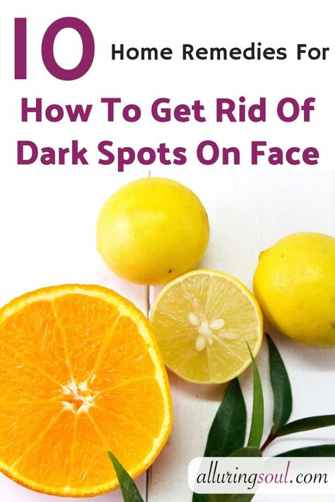 Dark spots on face form due to acne, blackheads, sun tan etc. Check out home remedies for how to remove black and dark spots on face which gives fast result Frankincense Anti Aging, Black Spots On Face, Face Form, Brown Spots On Skin, Aloe Vera Face Mask, Dark Spots On Face, Brown Spots Removal, Brown Spots On Face, Dark Spot Corrector