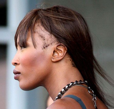 L'alopécie de traction est une maladie liée au tressage, au tissage et aux extensions qui peut causer une perte de cheveux permanente, lorsqu'on se tisse pendant des années ou si le tissage est trop serré! Ou lace wig à repetitions. Naomi Campbell Hair, Hair Implants, Stop Hair Breakage, Dunner Wordend Haar, Relaxed Hair, Hair Breakage, Hair Regrowth, Naomi Campbell, Bad Hair