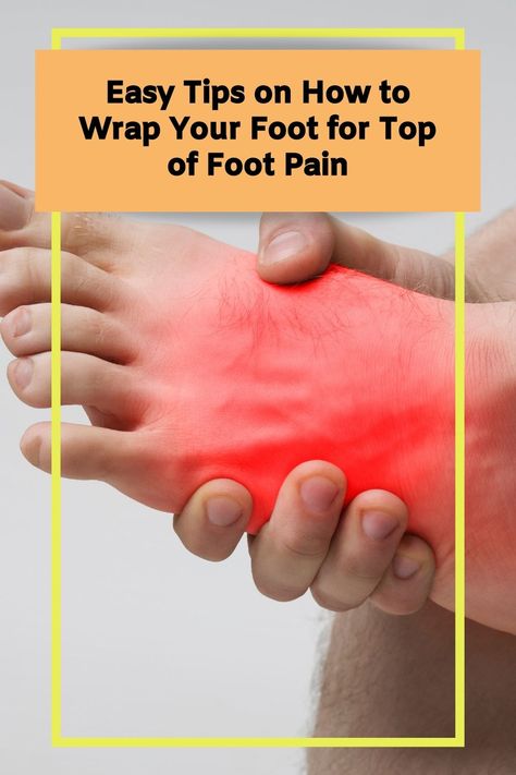 If you're experiencing pain on the top of your foot, it can be quite uncomfortable and limit your mobility. Here we will take a look at how to wrap your foot for top of foot pain. Top Of Foot Pain, Foot Stretches, Turmeric Health, How To Wrap, Natural Healing Remedies, Nerve Pain, Foot Pain, On The Top, Nerve