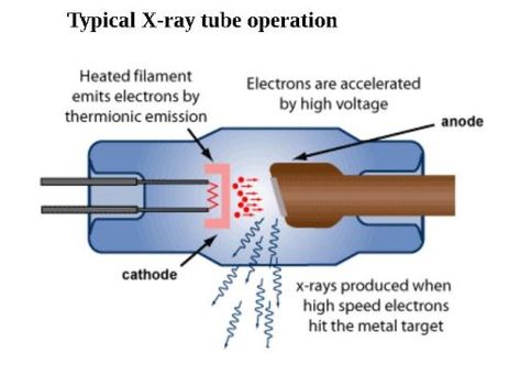 X-rays properties , uses and method of obtaining X-rays by using Coolidge tube Diffraction Grating, X Ray Tube, Gamma Rays, Bohr Model, Metal Targets, Electromagnetic Waves, Dental Exam, X Rays, Electromagnetic Radiation