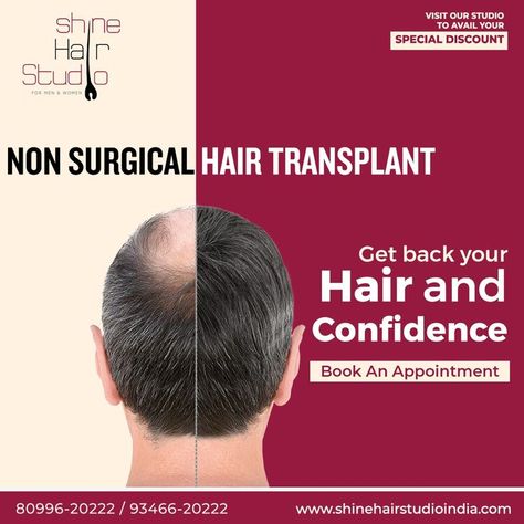 #hairpatches #hairpatchesrajahmundry #rajahmundry #Rajamahendravaram #hairwigsRajamahendravaram #hairextensionsRajamahendravaram #wigsinrajahmundry #hairservicesrajahmundry #hairfixingrajahmundry #hairpatchesinrajahmundry #hairreplacementrajahmundry #hairwigservicesrajahmundry #hairtoupeesrajahmundry #hairreplacementnonsurgicalrajahmundry #nonsurgicalhairreplacement #baldnesstreatmentrajahmundry
#humanhairrajahmundry #hairpatchservicesrajahmundry
#hairrajahmundry #haircarerajahmundry #wigs Thread Lift Face, Confidence Books, Laser Hair Reduction, Vampire Facial, Front Hair, Hair Fixing, Hair Clinic, Types Of Hair, Hair Extensions Best