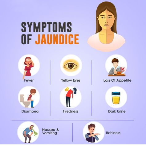 If you facing the problems such as fever , yellow eyes ,diarrhoea , tiredness , itchiness etc this all are various symptoms of Jaundice. For the solution of this you need to consult your doctor or to take care of this with the help of Hashmi's Jaundinil Capsule. #ayurveda #hashmi Jaundice Symptoms, Bilirubin Levels, Liver Function Test, Blood Disorders, Pathology Lab, Med School Motivation, Healthy Food Menu, Liver Function, Yellow Fever