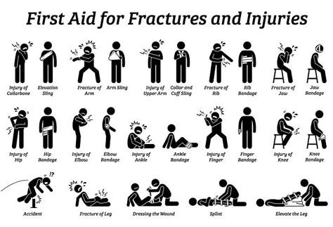 Survival Skills Life Hacks, Survival Life Hacks, Survival Techniques, Writing Inspiration Prompts, Survival Life, Medical Knowledge, Stick Figure, Book Writing Tips, Writing Advice