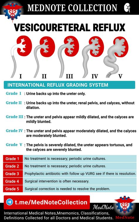 Urology Nursing, Pediatric Ultrasound, Cna Certificate, Pediatric Urology, Medical Radiography, Medical Terminology Study, Physician Assistant School, Student Doctor, Nurse Teaching