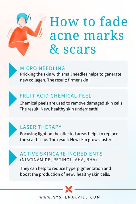 How To Reduce Acne Marks, Fading Acne Marks, Fade Acne Marks, How To Fade, Post Acne Marks, Reduce Hyperpigmentation, Skin Care Business, Aesthetic Medicine, Acne Marks