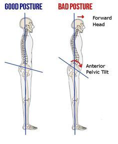 Did you know that your stomach pouch could be coming from a tilted pelvis? #fitness #health Hip Flexor Pain, Psoas Release, Posture Fix, Back Spasm, Hip Problems, Hip Flexor Stretch, Pelvic Tilt, Tight Hip Flexors, Belly Pooch