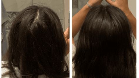 How To Easily Get Rid Of Back Hair Part [Tips + Prevention] - Hello Mia Wilson Cowlicks Back Of Head, How To Style Hair With Cowlicks, How To Get Rid Of A Cowlick, Back Part In Hair, Cowlick Back Of Head, Hair Cowlick, Cowlick Hairstyles, Parting Hair, Teased Hair