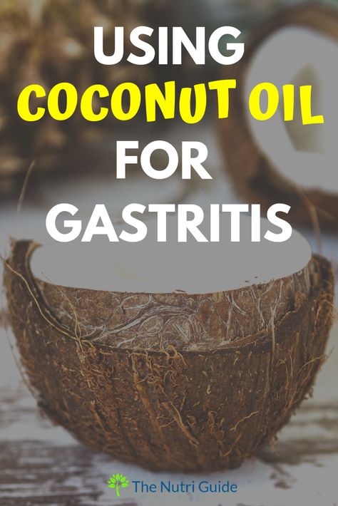 Learn how to use coconut oil to naturally treat gastritis- Naturally treat gastritis with the power of coconut oil #gastritis #coconutoil #gas #naturalremedy Coconut Oil For Gut Health, Acid Reflux Natural Remedies, Ulcer Diet, Home Remedies For Gas, Gut Cleanse, Fodmap Meal Plan, Reflux Recipes, Ibs Relief, Reflux Remedies