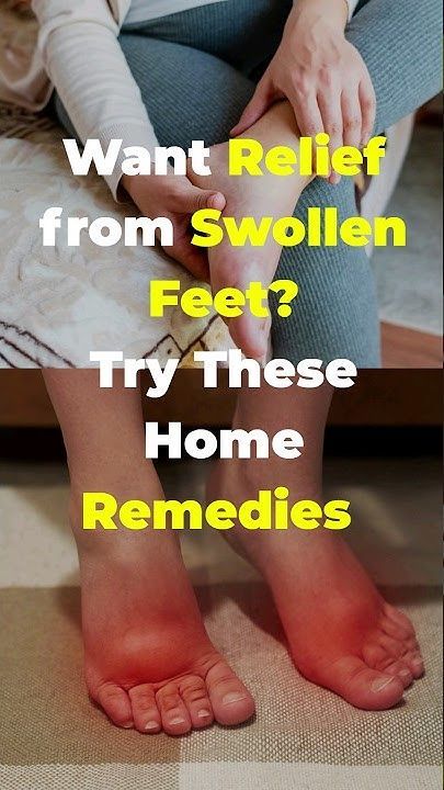 Swelling Feet Remedies, Feet Remedies, Swollen Ankles, Lower Extremity, Reduce Swelling, Health Info, Blood Flow, Get Healthy, Home Remedies