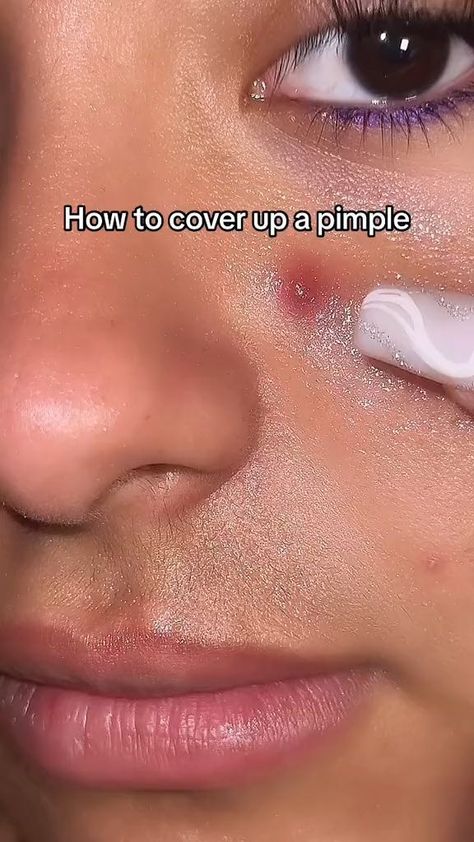 Bye pimple 👋 #pimple #howtocoverapimple #makeuphacks Credits:@ipsy Pimples On Face, Simple Makeup Tips, Makeup Artist Tips, Makeup Help, Easy Makeup Tutorial, Face Makeup Tips, Simple Makeup Looks, Face Makeup Tutorial, روتين العناية بالبشرة