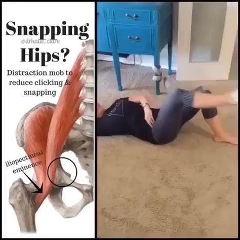 Better Posture By FlexibleBear on Instagram: “Snapping Hip Syndrome💫 . Real talk- bodies are noooisy. Just because you're having clicking/popping does NOT automatically mean anything is…” Hip Clicking, Hip Impingement Exercises, Snapping Hip Syndrome, Hip Impingement, Better Posture, Real Talk, Everyone Else, Just Because, Hanging Out