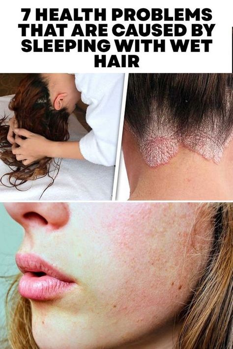 7 Health Problems That Are Caused By Sleeping With Wet Hair Sleep With Wet Hair, Healing Salve Recipe, Sleeping With Wet Hair, Intimate Wash, Tea Health Benefits, Women Health Care, Healthy Advice, Simple Health, Health Fitness Motivation