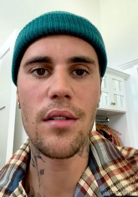 Facial Paralysis, Justin Bieber, Disease, Facial