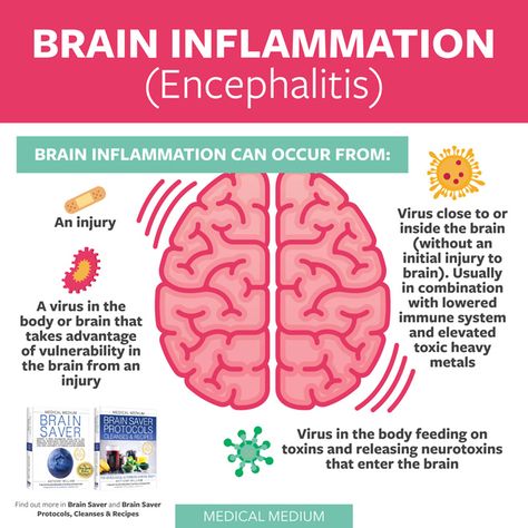 Brain Inflammation (Encephalitis) Brain Inflammation, Severe Fatigue, Brain Stem, Medical Medium, Viral Infection, Cleanse Recipes, Health Articles, Healthy Fitness, Autoimmune Disease