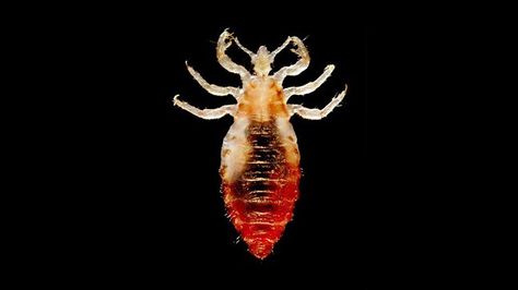 Pediculus humanus (body louse). The louse can be contracted from infected clothing or cloth-covered chairs in public places such as movie theaters. They are sensitive to temperature and will typically leave hosts who are running fevers. They can transmit microbes that can cause Rickettsia, typhus and trench fever. https://www.healthline.com/health/body-lice Lice Pictures, How To Treat Lice, Lice Eggs, Lice Removal, Bacterial Diseases, Head Louse, Hidden Words, School Age, Pediatrics