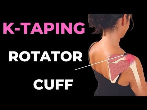 How to treat Shoulder pain - rotator cuff and bursitis with Kinesiology taping techniques - YouTube How To Kt Tape Your Shoulder, Rotator Cuff Taping, Kt Tape Shoulder Rotator Cuff, Rotator Cuff Kt Taping, Shoulder Taping For Pain, How To Tape Shoulder For Pain, Kinesiology Taping Shoulder, Kt Tape Shoulder, Kinesio Taping Shoulder