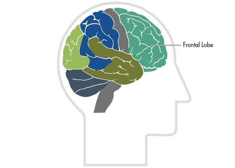 Intracerebral Hemorrhage, Frontal Lobe Damage, Frontal Lobe Function, Parietal Lobe, Finger Tapping, Injury Quotes, Card Sorting, Psychological Testing, Occipital Lobe