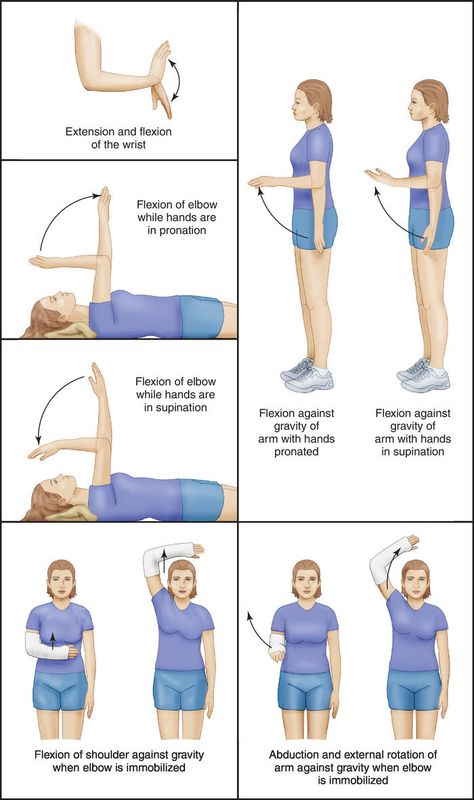 Elbow Range Of Motion Exercises, Range Of Motion Nursing, Passive Range Of Motion Exercises, Arm Excersises, Range Of Motion Exercises, Elbow Exercises, Medical Dictionary, Muscle Testing, Nursing Care Plan