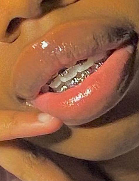 100 % recommend silver as your next braces choice🤍😘 | Cute braces, Braces colors, Brace face Shoe Recommendation, Power Chain Braces, Braces On Teeth, Braces Aesthetic, Braces For Teeth, Braces Cute, Silver Braces, Braces Colors Ideas, Jewelry Teeth