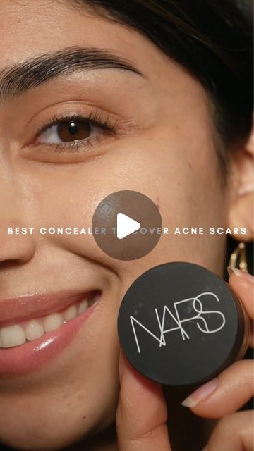 938K views · 34K likes | Mia Galvan on Instagram: "It’s Macro Monday!🫶🏼✨ Featuring the @narsissist soft matte complete concealer in café con leche! My favorite for covering acne & scars!☺️ #nars #concealer #acnescars #makeuptips" Nars Soft Matte Complete Concealer, Nars Soft Matte Concealer, Covering Acne, Nars Concealer, Matte Concealer, Nars, Concealer, Makeup Tips, My Favorite