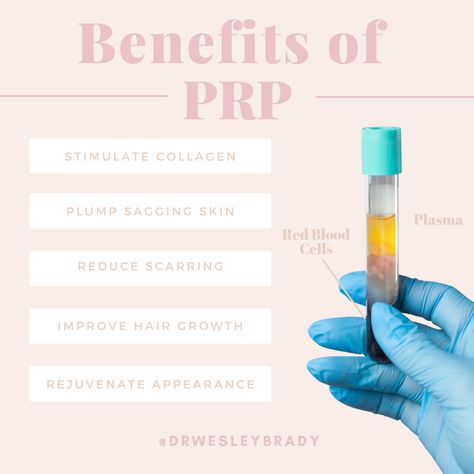 Vampire Facial Benefits, Prp Aesthetics, Prp Benefits, Prp Facial, Plasma Facial, Facial Benefits, Esthetician Inspiration, Prp Hair, Vampire Facial