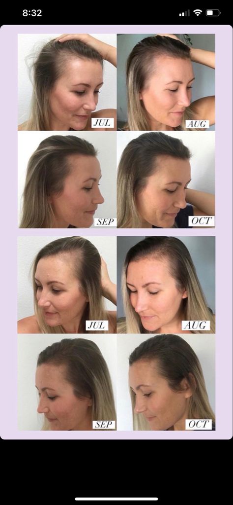 Monat Damage Repair Leave In Creme, Monat Before And After Hair, Monat Before And After, Before And After Hair, Leave In, Side Hustle, You Choose, Photo Sharing, Repair